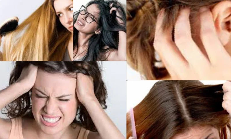 Kadınların Korkulu Kabusu Saç Diplerinde Ağrı