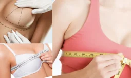 Meme Büyütme Ameliyatı Kalıcı Sonuç Sağlar Mı?