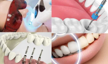 Düzce Diş Beyazlatma ve Estetik Gülüşler